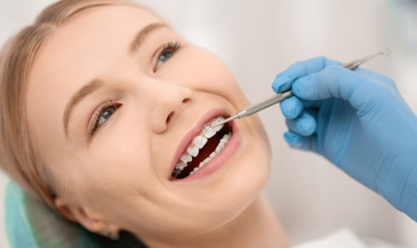Ceramic Braces in Red Lion
