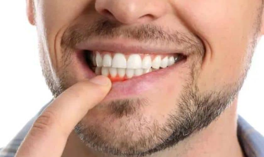 "Patient visits at F&S Orthodontics and Periodontics, Red Lion, for Periodontics Treatment"