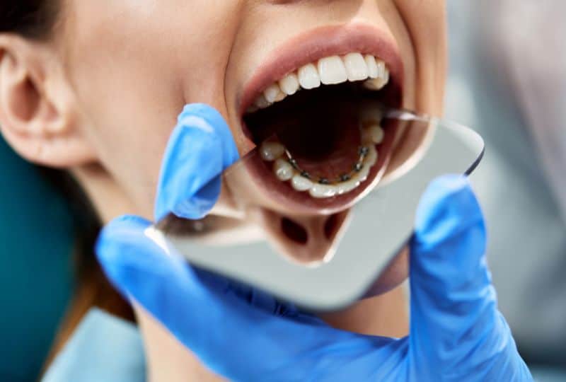 emergency orthodontist Red Lion