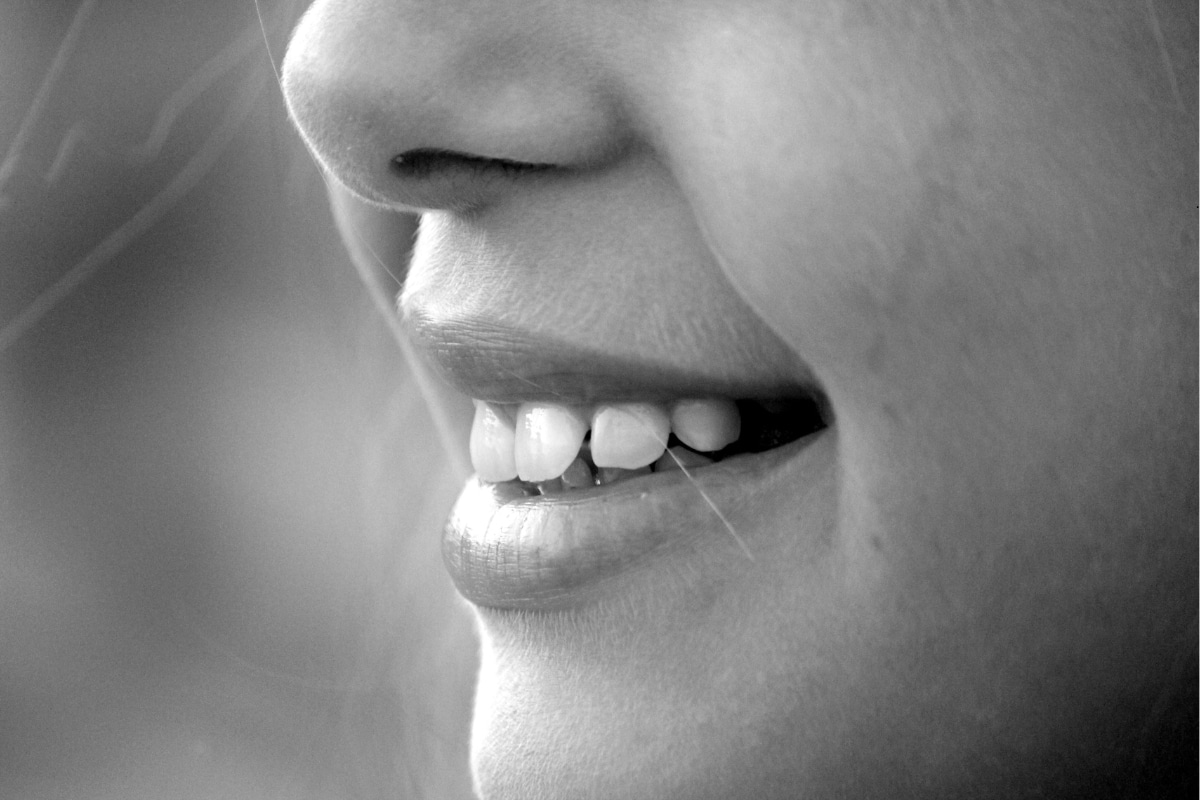 Black Triangles Between Teeth | York Orthodontist