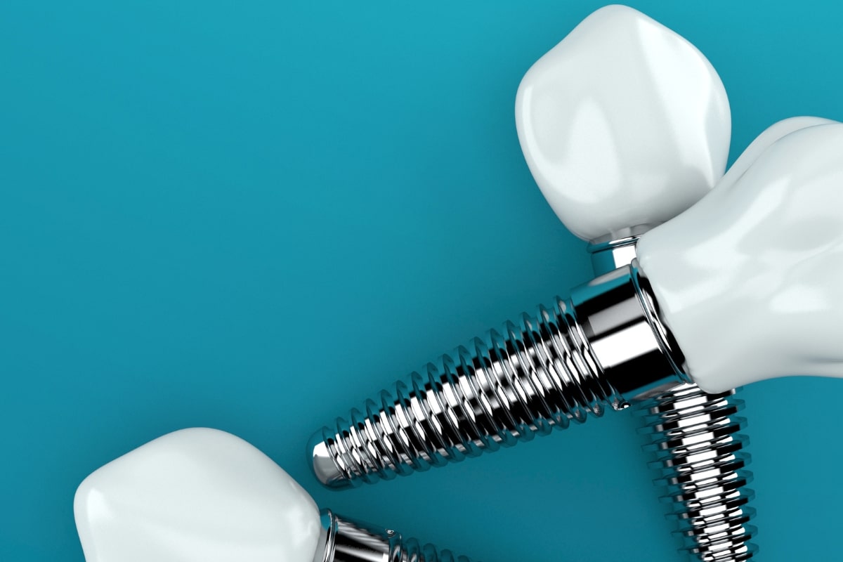 Dental Implant Red Lion