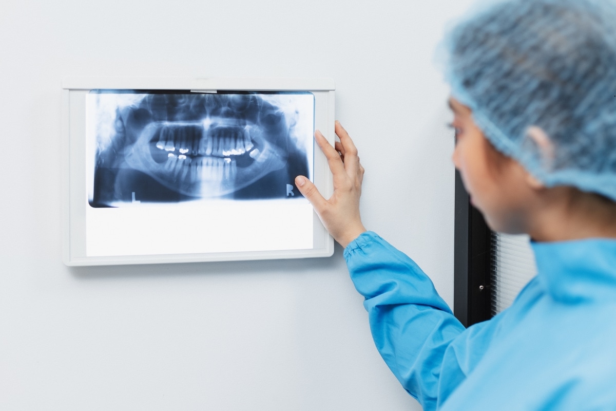 Dental Scan