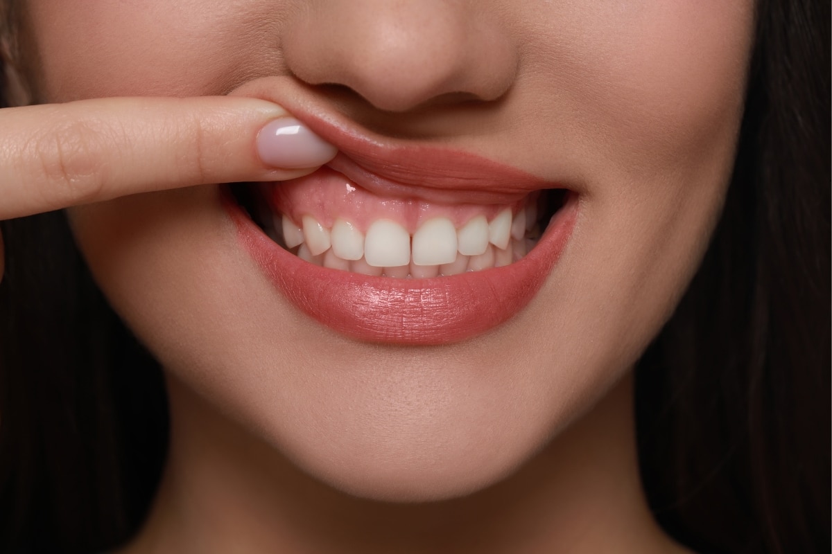 tips for healthy gums by FS Ortho Red Lion