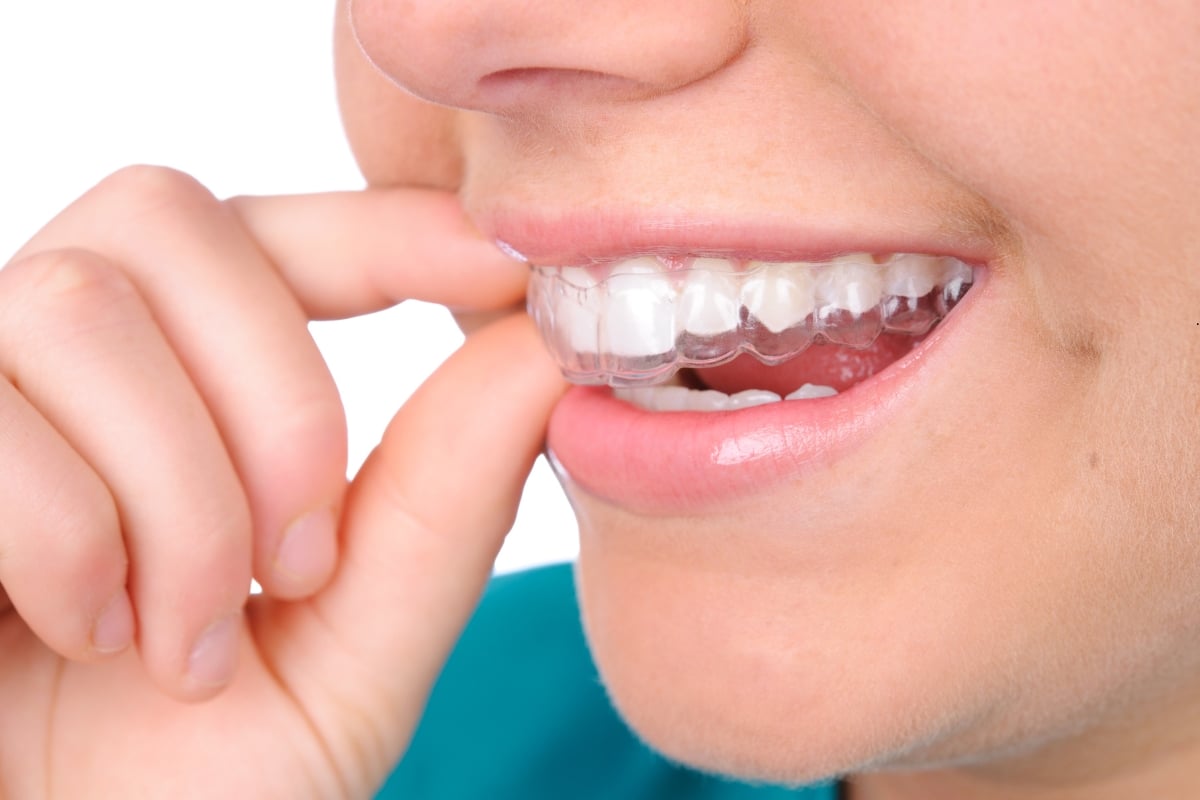 Dental Retainer by FS Ortho Red Lion And York