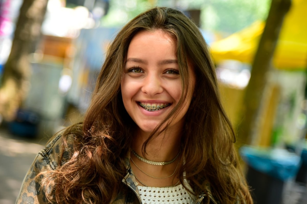 Oral Hygiene with braces