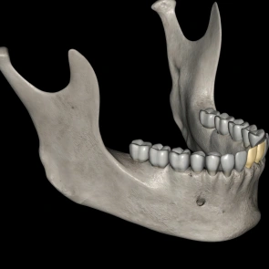 Preserving Jawbone Health