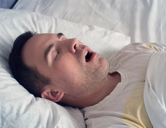 Upper Airway Resistance Syndrome (UARS)